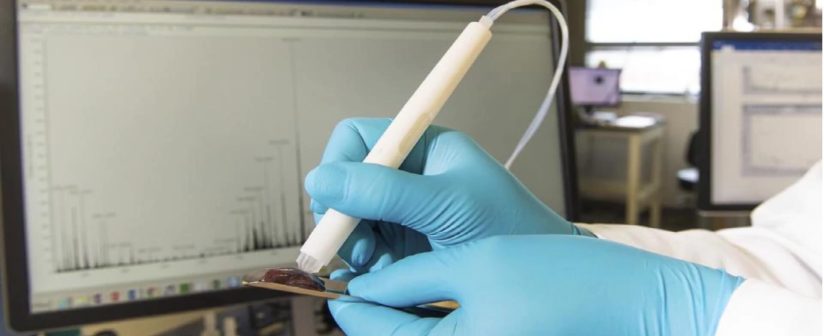 ‘Pen’ identifies cancer in 10 seconds