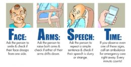 Signs And Symptoms Of Stroke