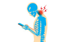 Text Neck DAMAGING OUR SPINES